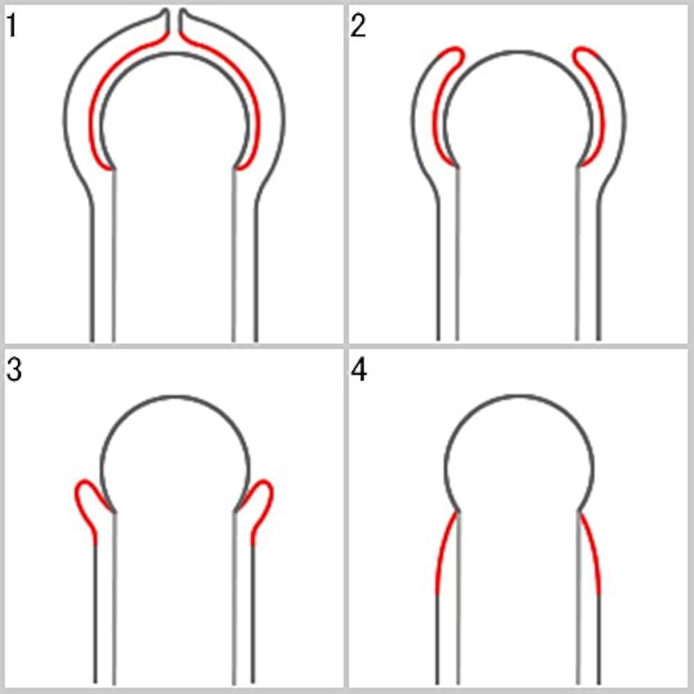 医療用ステンレスを採用